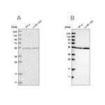 DARS Antibody in Western Blot (WB)