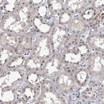 KLDC3 Antibody in Immunohistochemistry (Paraffin) (IHC (P))