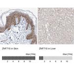 ZNF710 Antibody in Immunohistochemistry (IHC)