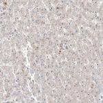 ZNF710 Antibody in Immunohistochemistry (IHC)