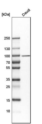 UFL1 Antibody in Western Blot (WB)