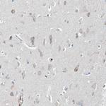 GALNTL6 Antibody in Immunohistochemistry (Paraffin) (IHC (P))