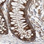 ZC3H15 Antibody in Immunohistochemistry (IHC)