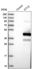 KTI12 Antibody in Western Blot (WB)