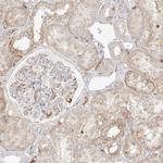 MTX2 Antibody in Immunohistochemistry (IHC)