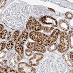 MTX2 Antibody in Immunohistochemistry (Paraffin) (IHC (P))