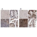 ASCC3 Antibody in Immunohistochemistry (IHC)