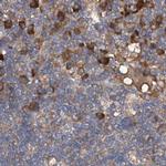 ASCC3 Antibody in Immunohistochemistry (IHC)