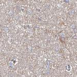 ASCC3 Antibody in Immunohistochemistry (IHC)