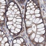 ASCC3 Antibody in Immunohistochemistry (IHC)