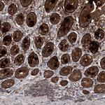 ASCC3 Antibody in Immunohistochemistry (IHC)