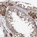 ASCC3 Antibody in Immunohistochemistry (IHC)