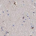 ASCC3 Antibody in Immunohistochemistry (IHC)