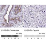 ANKRD45 Antibody in Immunohistochemistry (IHC)