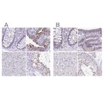 ANKRD45 Antibody in Immunohistochemistry (IHC)