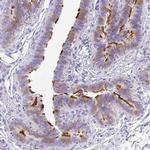 ANKRD45 Antibody in Immunohistochemistry (IHC)