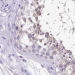 ANKRD45 Antibody in Immunohistochemistry (IHC)