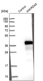 ANKRD45 Antibody in Western Blot (WB)