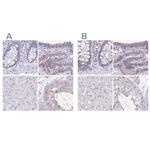 ANKRD45 Antibody in Immunohistochemistry (IHC)