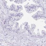 ANKRD45 Antibody in Immunohistochemistry (IHC)