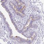 ANKRD45 Antibody in Immunohistochemistry (IHC)