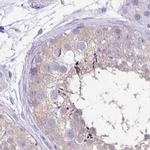 ANKRD45 Antibody in Immunohistochemistry (IHC)