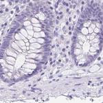 ANKRD45 Antibody in Immunohistochemistry (IHC)