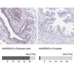 ANKRD45 Antibody