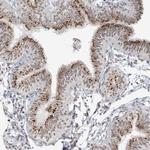 GPR107 Antibody in Immunohistochemistry (Paraffin) (IHC (P))