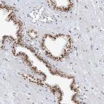 GPR107 Antibody in Immunohistochemistry (Paraffin) (IHC (P))