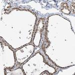 GPR107 Antibody in Immunohistochemistry (IHC)