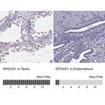 SPOCD1 Antibody in Immunohistochemistry (IHC)