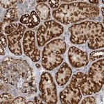 COA3 Antibody in Immunohistochemistry (Paraffin) (IHC (P))