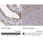 PEX13 Antibody in Immunohistochemistry (IHC)