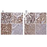 PEX13 Antibody in Immunohistochemistry (IHC)