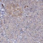 PEX13 Antibody in Immunohistochemistry (IHC)