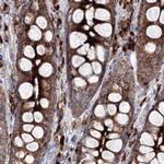 PEX13 Antibody in Immunohistochemistry (IHC)