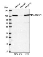 RAB3GAP1 Antibody