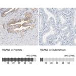 RCAN3 Antibody in Immunohistochemistry (IHC)