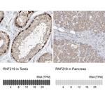 C13orf7 Antibody