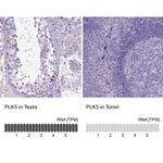 PLK5 Antibody in Immunohistochemistry (IHC)