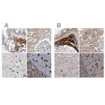 NAGK Antibody in Immunohistochemistry (IHC)