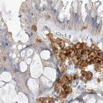 NAGK Antibody in Immunohistochemistry (IHC)