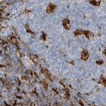 NAGK Antibody in Immunohistochemistry (IHC)