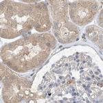 NAGK Antibody in Immunohistochemistry (IHC)