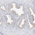 RASA2 Antibody in Immunohistochemistry (IHC)