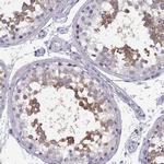 TTC21A Antibody in Immunohistochemistry (IHC)