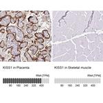 KISS1 Antibody in Immunohistochemistry (IHC)