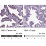 NEK5 Antibody in Immunohistochemistry (IHC)