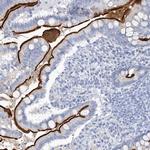 VILL Antibody in Immunohistochemistry (IHC)